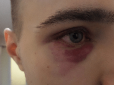 У Броварах група підлітків била перехожого, а поліція не прийняла жодних мір
