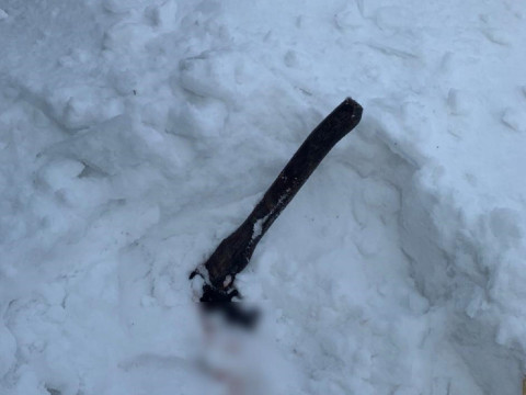 На Бориспільщині місцевий житель вдарив дружину сокирою по голові (ФОТО)