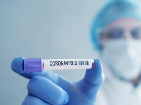 Комерційний директор "Росави" одужав від коронавірусу (ВІДЕО)