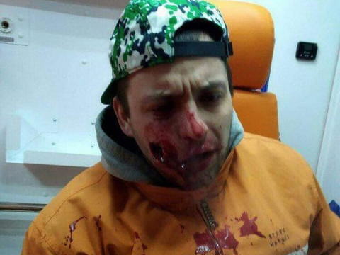 В Українці біля магазину невідомі розстріляли хлопця: оголошено збір коштів на лікування (ФОТО)