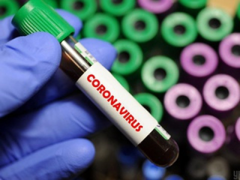 Кількість хворих коронавірусом на Київщині знову зросла, - МОЗ
