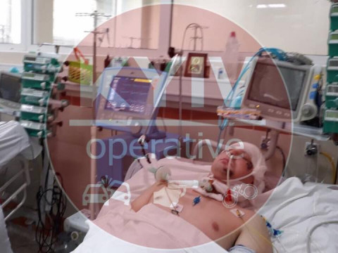 На Київщині чоловік, який потрапив під колеса автомобіля потребує негайної допомоги  