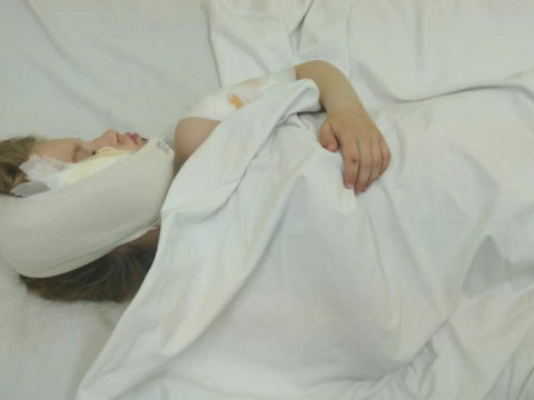 У Вишневому собака ледь не загризла дівчинку: сім'я потребує допомоги (ФОТО)