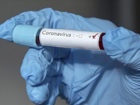 Кількість хворих коронавірусом на Київщині зросла до 52, - МОЗ
