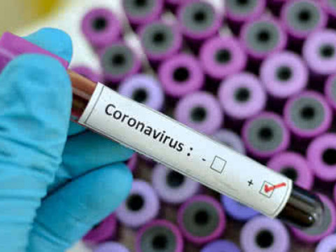 У Броварах зафіксовано п’ять хворих на COVID-19