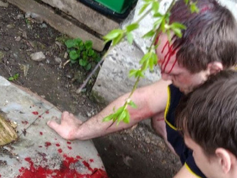 У Клавдієво-Тарасовому роми влаштували жорстоку бійку з місцевими (ФОТО)
