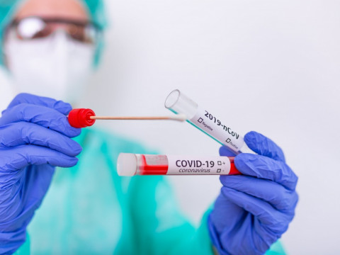 На Київщині за добу більше людей одужали від COVID-19, ніж захворіли