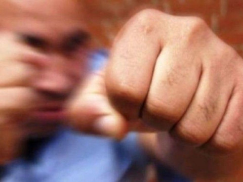 В Обухові шукають свідків жорстокого побиття поблизу супермаркету
