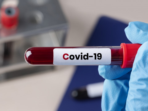 На Київщині захворіли на COVID-19 більше людей, ніж одужали