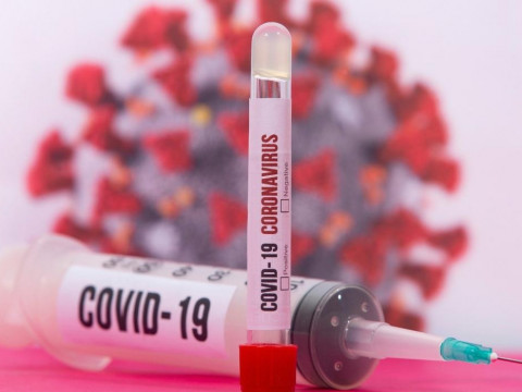На Київщині за добу на коронавірус захворіло 66 осіб