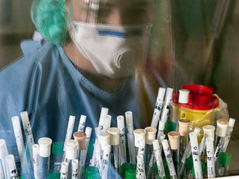 На Київщині коронавірусом захворіло 7880 людей