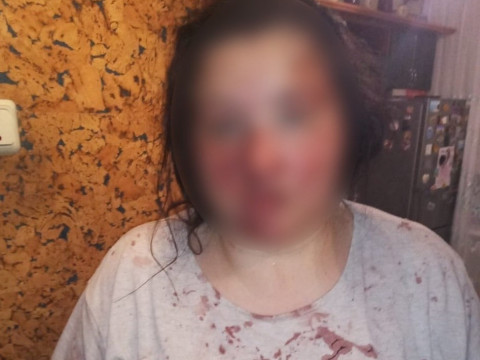 На Вишгородщині п’яний чоловік жорстоко познущався зі своєї знайомої