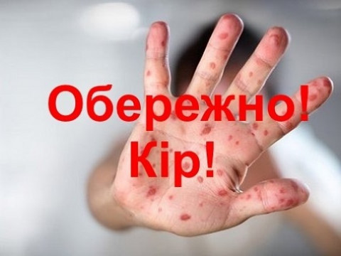 У військовій частині Борисполя "гуляє" кір