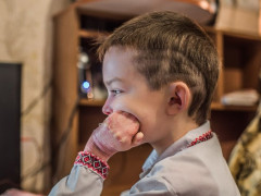 В Обухові хлопчик зі шкірою "метелика" потребує допомоги