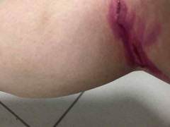 Бродячі собаки покусали жінку в Броварах