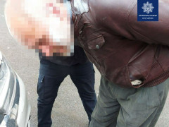 У Білій Церкві психічно-хворий чоловік хотів підпалити квартиру