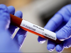 У Білій Церкві з початку року на коронавірус захворіло 3260 людей