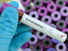 На Київщині 29 людей звернулися в лікарні з підозрою на Covid-19