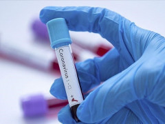В Обухівському районі виявили половину всіх хворих на коронавірус в області