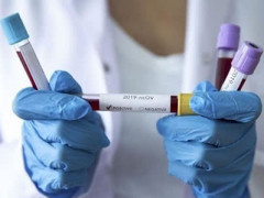У Гостомелі підтвердили другий випадок COVID-19 у семінариста