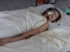 Допоможіть опізнати: у Васильківській лікарні знаходиться молода дівчина після ДТП (ФОТО)