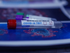 На Київщині кількість хворих коронавірусом наближається до тисячі, - МОЗ