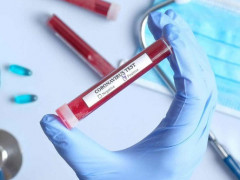 На Київщині невпинно зростає кількість хворих на коронавірус