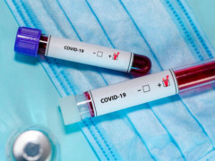 Коронавірус на Київщині: вже зафіксовано 224 випадки захворювання