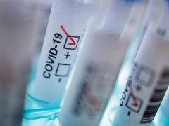 Коронавірус продовжує "атакувати" жителів Київщини