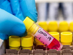 Стало відомо, у яких районах Київщини мешканці захворіли на COVID-19