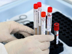 На Київщині за добу зафіксували понад 200 випадків захворювання на COVID-19