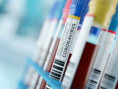 Кабмін виділив 100 млн грн для тестування на коронавірус