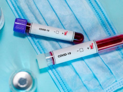 Коронавірусні новини: за день померла одна людина
