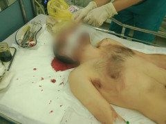 Поблизу Вишневого невідомі жорстоко побили місцевого таксиста