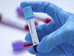 На Київщині облаштували шість пунктів для обсервації евакуйованих громадян