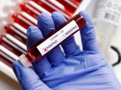 На Київщині за добу на коронавірус захворіло 36 осіб