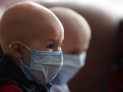 У Білій Церкві 30% онкохворих відмовляюся від лікування, - Ярослав Колесников 