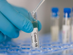 Кількість хворих на COVID-19 на Київщині: дані станом на 24 березня