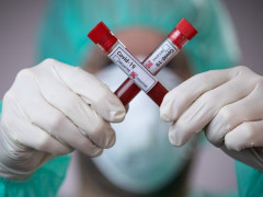 На Київщині кількість хворих на Covid-19 за добу зменшилась до 826