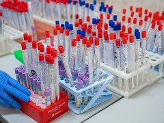 Коронавірусна статистика: за добу захворіло ще 22 людини