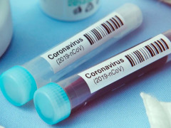 За добу від COVID-19 на Київщині померло двоє літніх чоловіків