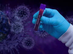 За день близько 400 мешканців Київщини інфікувались на COVID-19