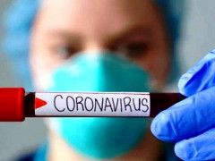 Хворих на коронавірус виявили лише у трьох районах Київщини