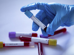 У Київській області шість дітей заразилися коронавірусом
