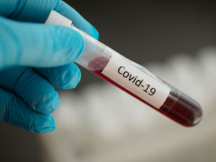 На Київщині зафіксували понад три тисячі випадків захворювання на COVID-19