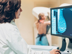 Жінки з Іванкова мають можливість безкоштовно зробити мамографію
