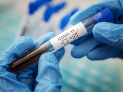 На Київщині різко впала кількість інфікованих на COVID-19