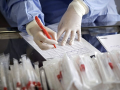 За минулу добу ще у 25 мешканців Київщини діагностували коронавірус