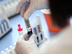 Понад 200 хворих на коронавірус виявили за добу на Білоцерківщині