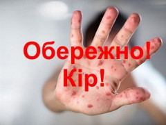 У військовій частині Борисполя "гуляє" кір